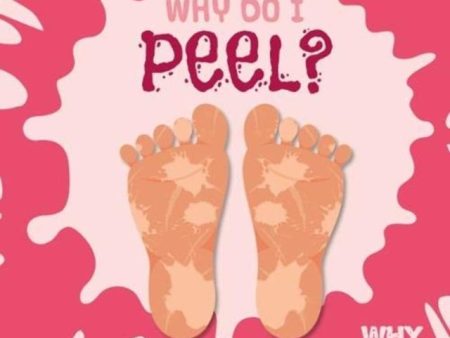 Why Do I Peel? Online